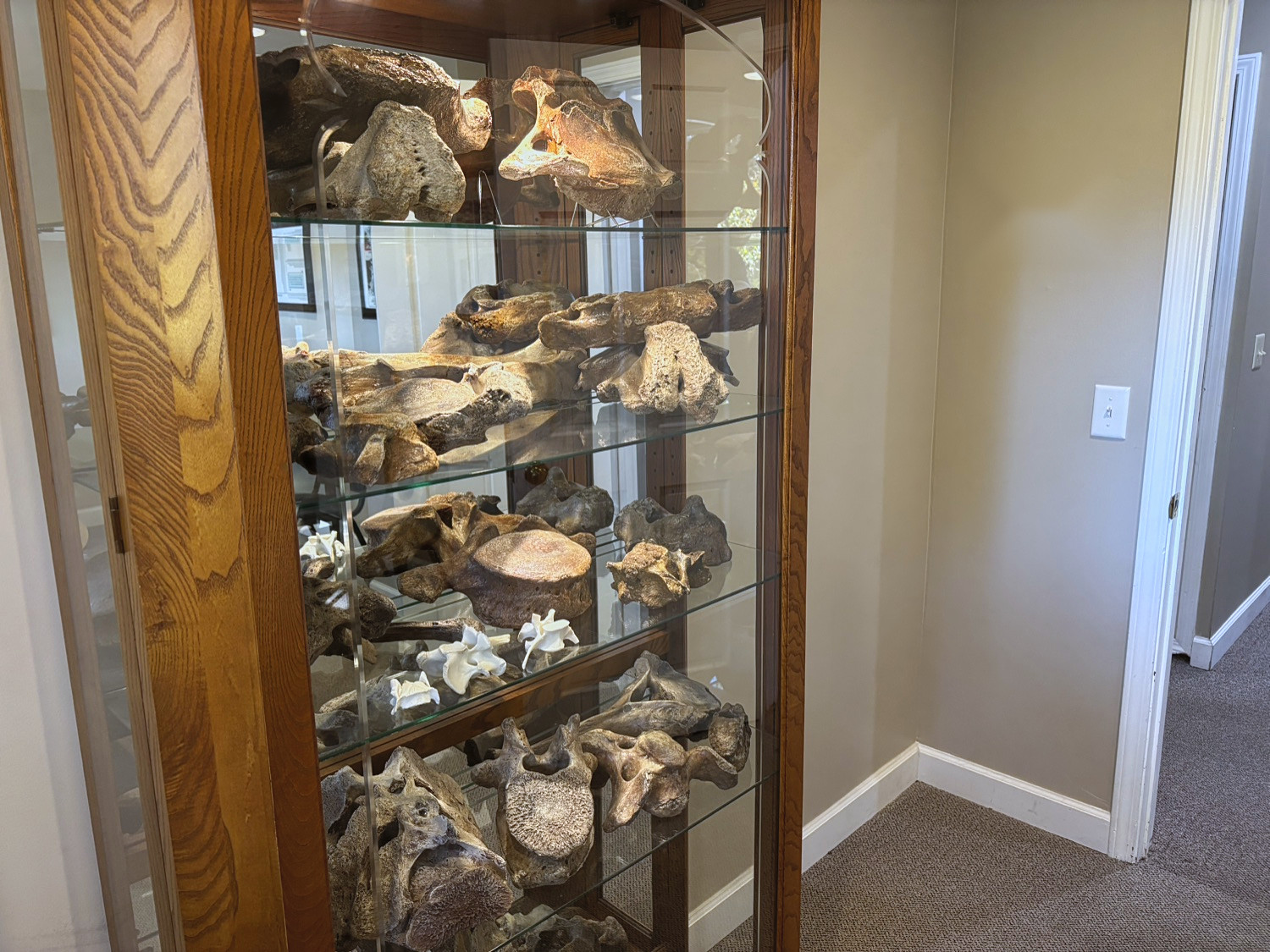 Woolly mammoth fossils in a wood and glass display case in the clinic hallway